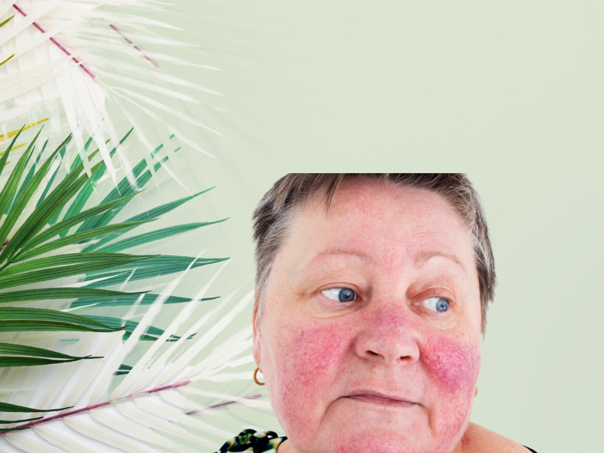 Rosacée, Couperose, Psoriasis, Eczéma, Rougeur