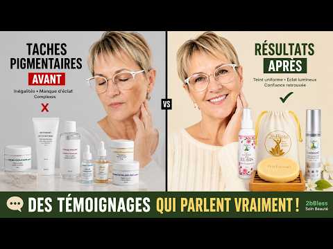 Témoignage 2bBless – taches / éclat