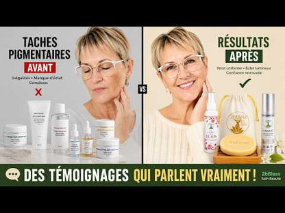 Témoignage 2bBless – taches / éclat